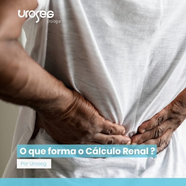 Publicação da Uroseg no Instagram: O que forma o Cálculo Renal